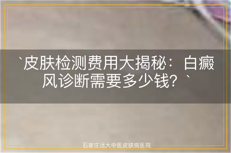 皮肤检测费用大揭秘：白癜风诊断需要多少钱？