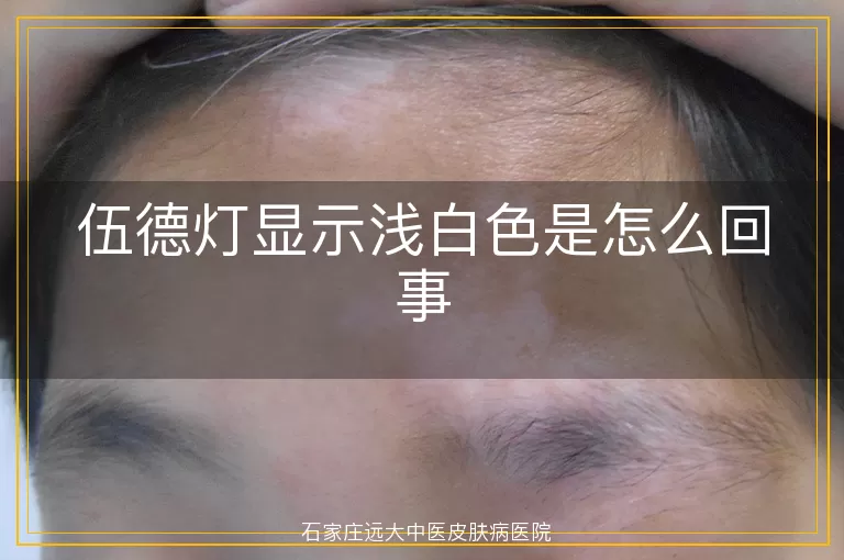 伍德灯显示浅白色是怎么回事