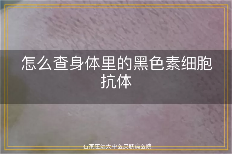 怎么查身体里的黑色素细胞抗体
