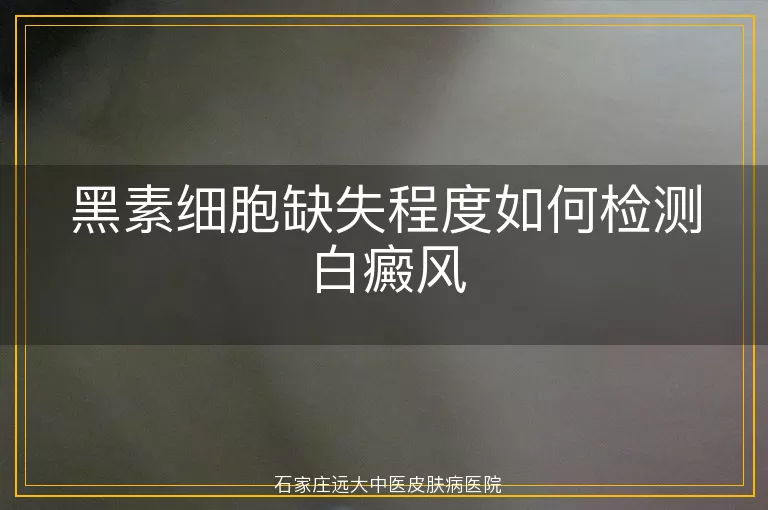 黑素细胞缺失程度如何检测白癜风
