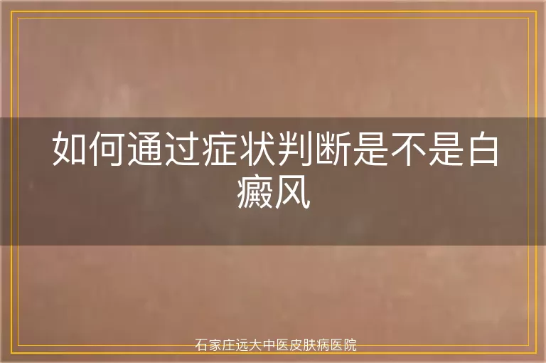 如何通过症状判断是不是白癜风