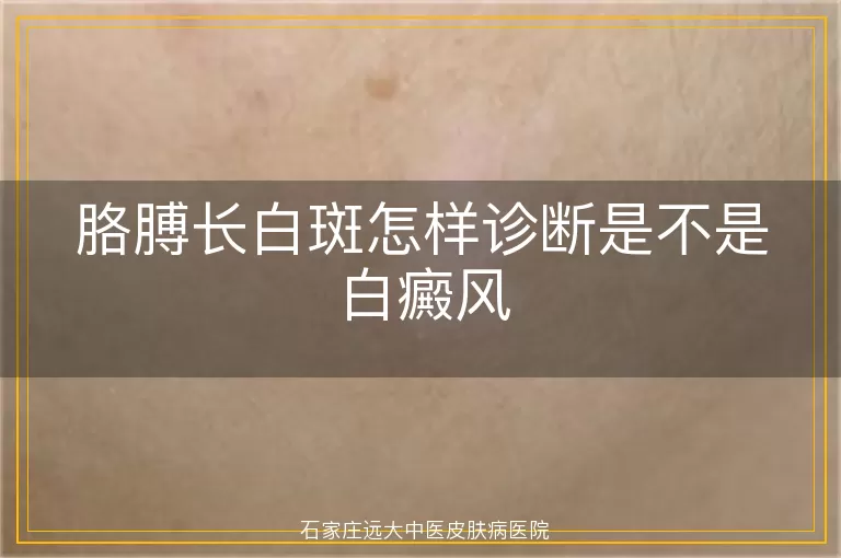 胳膊长白斑怎样诊断是不是白癜风