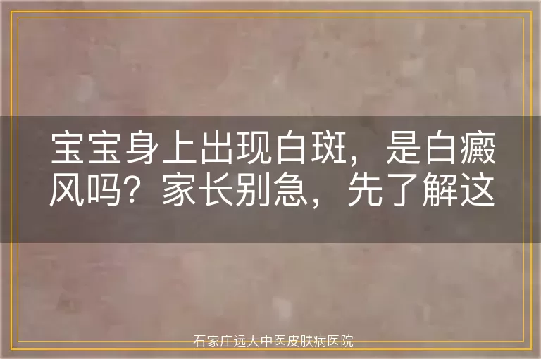 宝宝身上出现白斑，是白癜风吗？家长别急，先了解这些