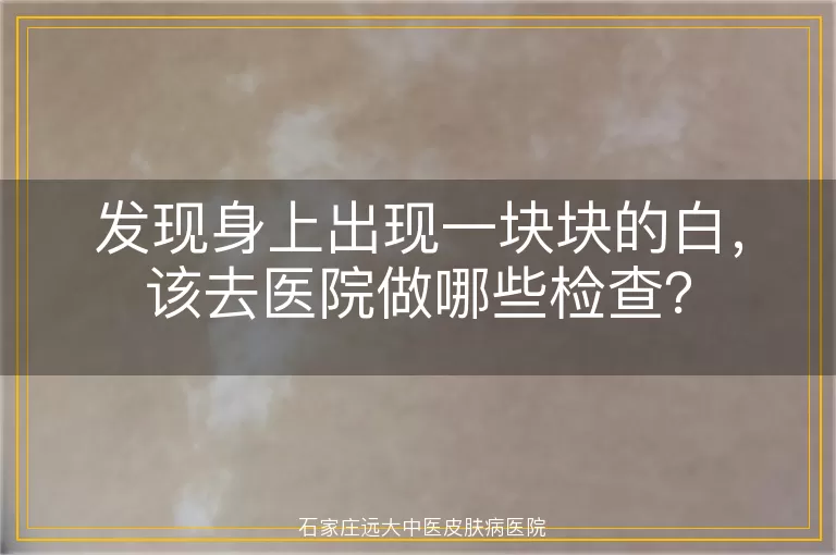发现身上出现一块块的白，该去医院做哪些检查？