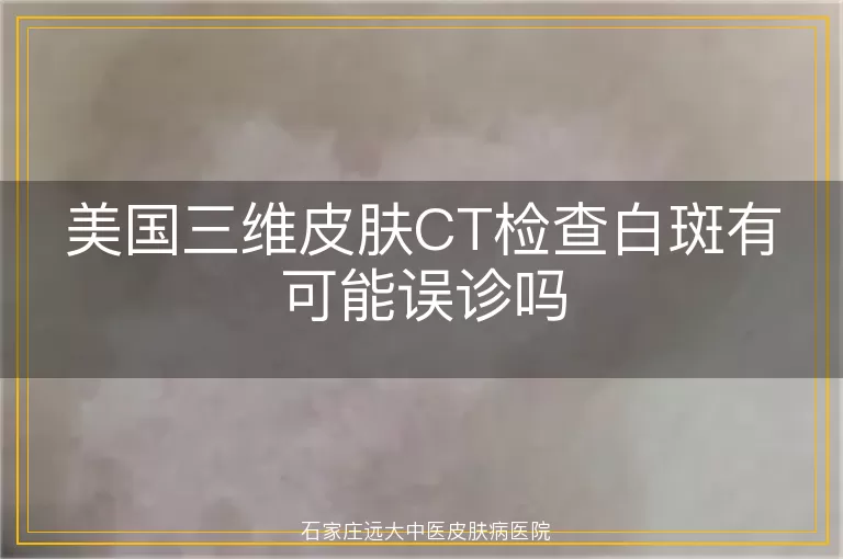 美国三维皮肤CT检查白斑有可能误诊吗