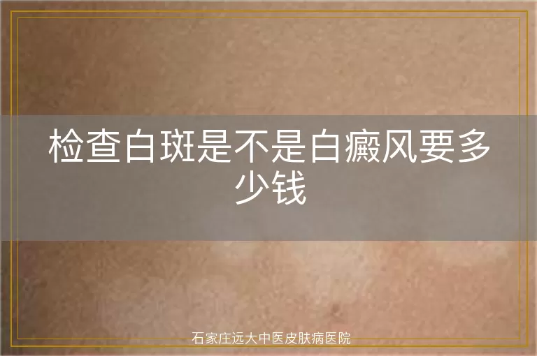 检查白斑是不是白癜风要多少钱