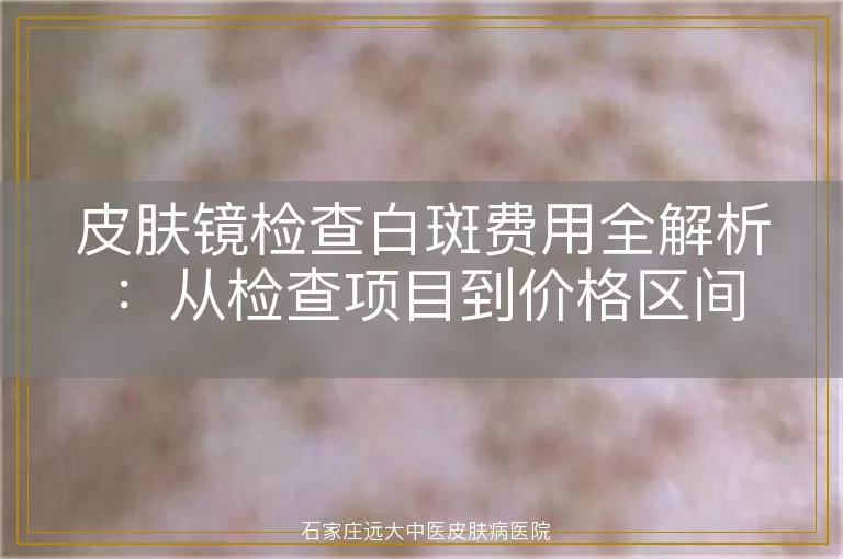 皮肤镜检查白斑费用全解析：从检查项目到价格区间