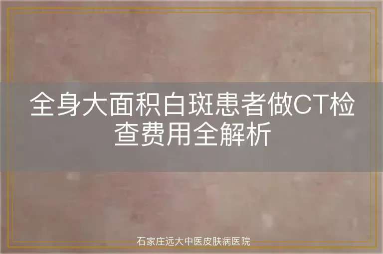 全身大面积白斑患者做CT检查费用全解析