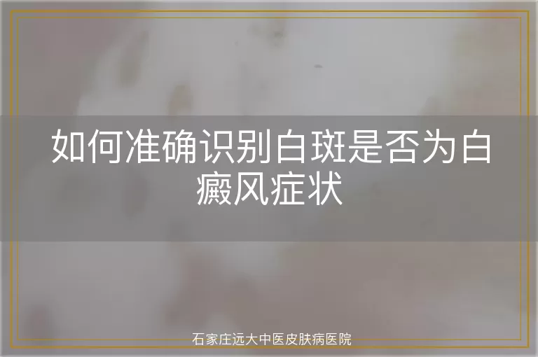 如何准确识别白斑是否为白癜风症状