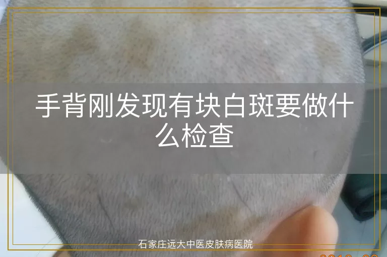 手背刚发现有块白斑要做什么检查