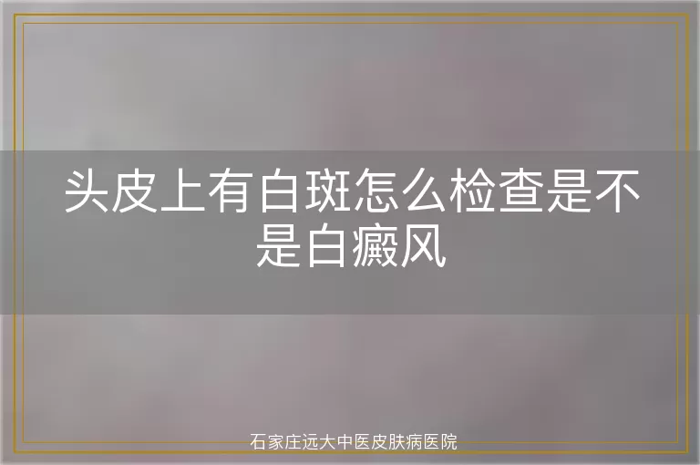 头皮上有白斑怎么检查是不是白癜风