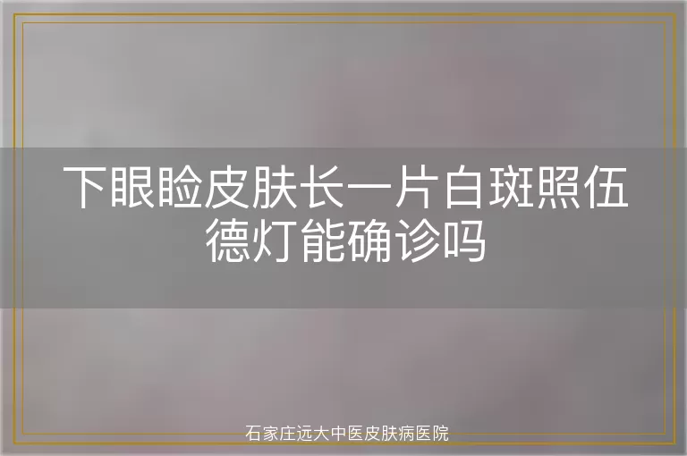 下眼睑皮肤长一片白斑照伍德灯能确诊吗