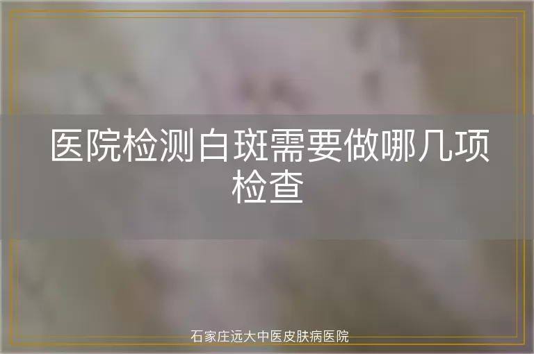 医院检测白斑需要做哪几项检查