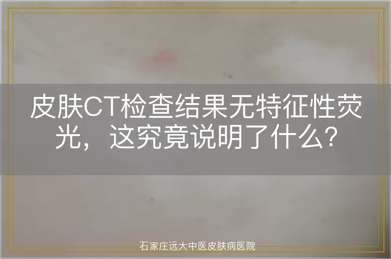 皮肤CT检查结果无特征性荧光，这究竟说明了什么？