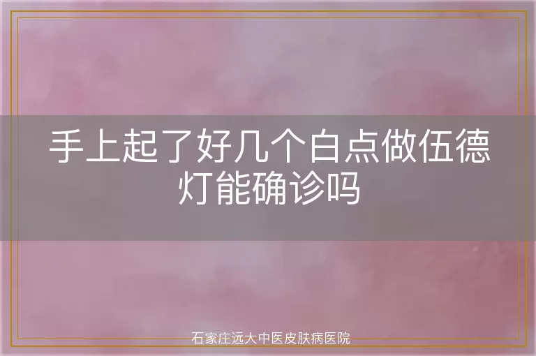手上起了好几个白点做伍德灯能确诊吗