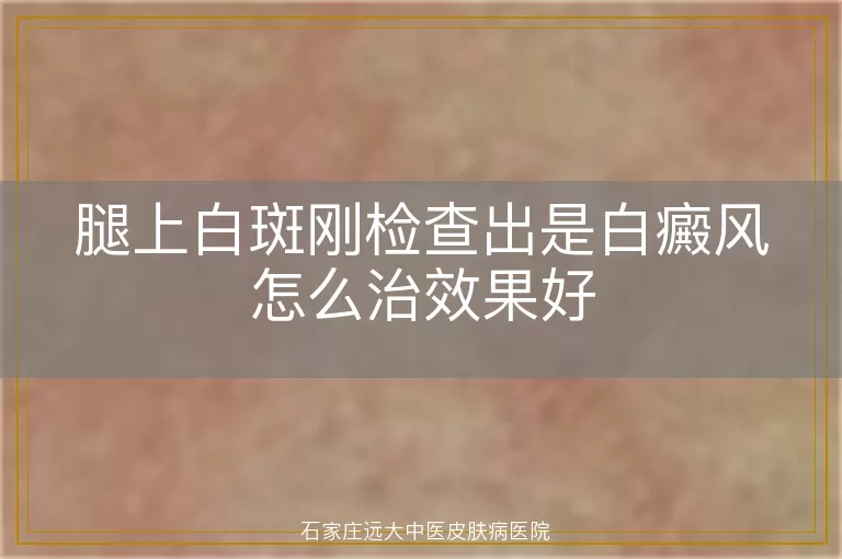 腿上白斑刚检查出是白癜风怎么治效果好