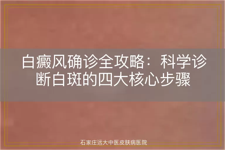 白癜风确诊全攻略:科学诊断白斑的四大核心步骤