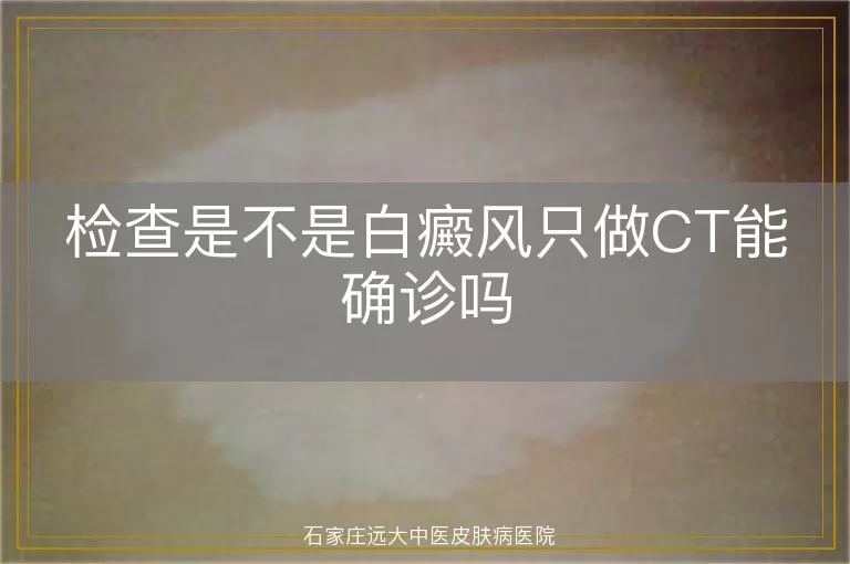 检查是不是白癜风只做CT能确诊吗