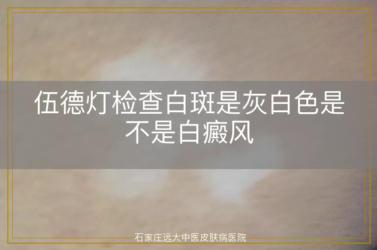 伍德灯检查白斑是灰白色是不是白癜风