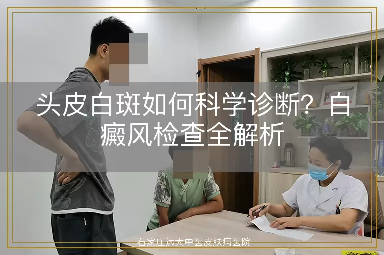 头皮白斑如何科学诊断？白癜风检查全解析