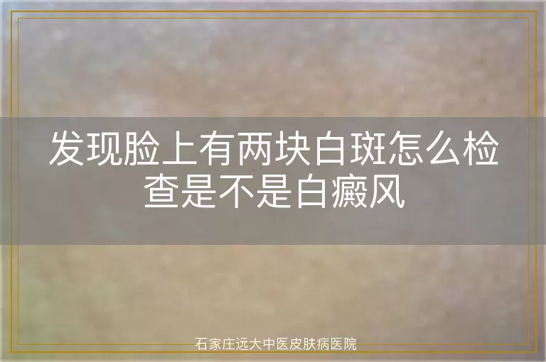 发现脸上有两块白斑怎么检查是不是白癜风