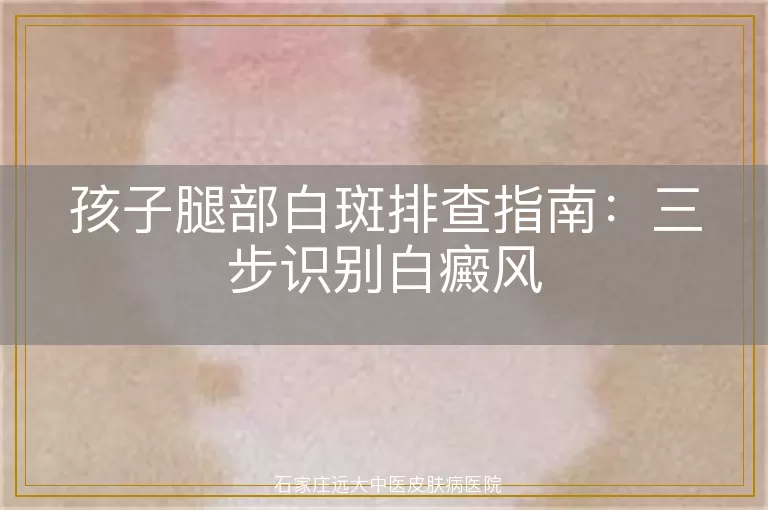孩子腿部白斑排查指南：三步识别白癜风