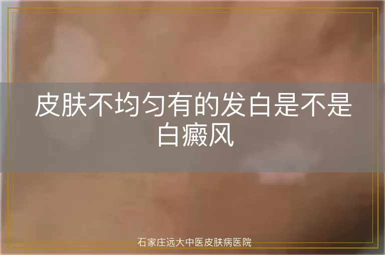 皮肤不均匀有的发白是不是白癜风