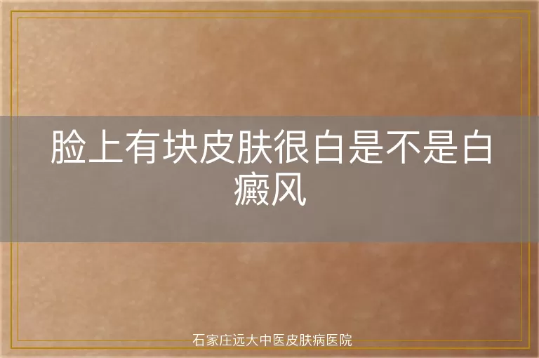 脸上有块皮肤很白是不是白癜风