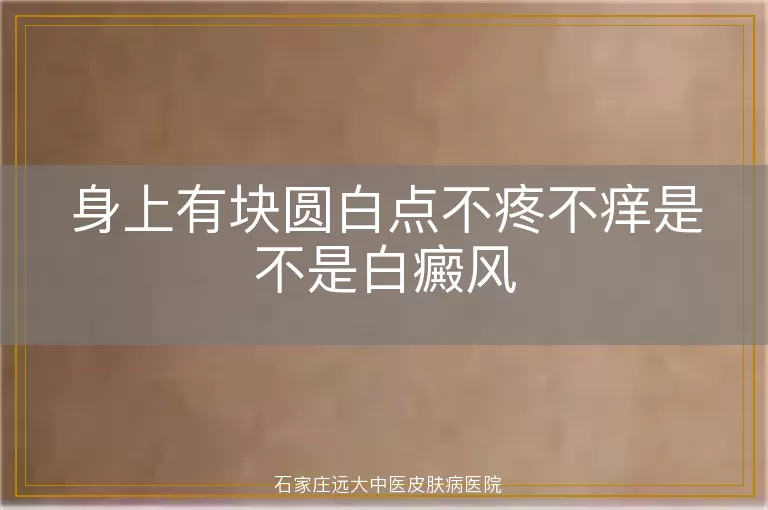 身上有块圆白点不疼不痒是不是白癜风