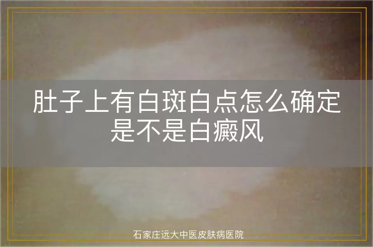 肚子上有白斑白点怎么确定是不是白癜风