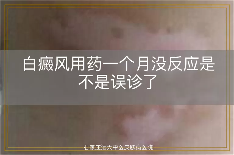 白癜风用药一个月没反应是不是误诊了