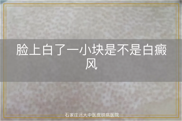 脸上白了一小块是不是白癜风
