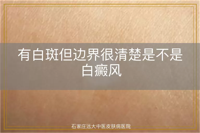 有白斑但边界很清楚是不是白癜风