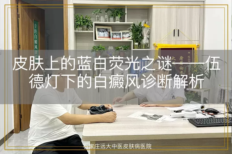 皮肤上的蓝白荧光之谜——伍德灯下的白癜风诊断解析