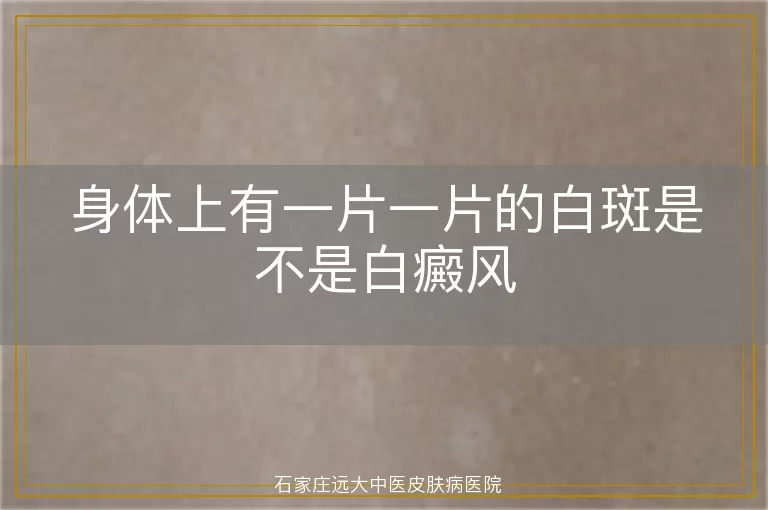 身体上有一片一片的白斑是不是白癜风