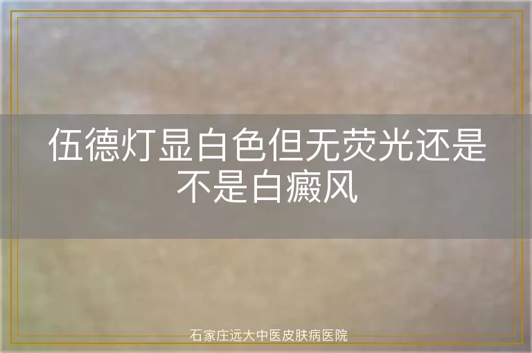 伍德灯显白色但无荧光还是不是白癜风