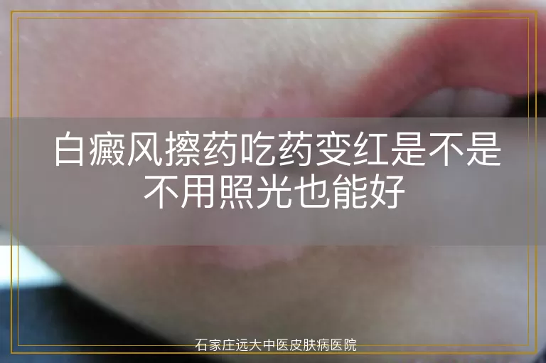 白癜风擦药吃药变红是不是不用照光也能好