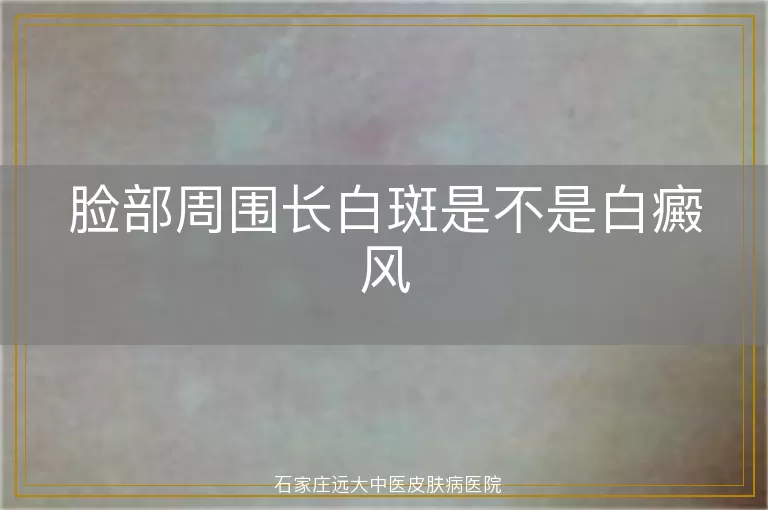 脸部周围长白斑是不是白癜风
