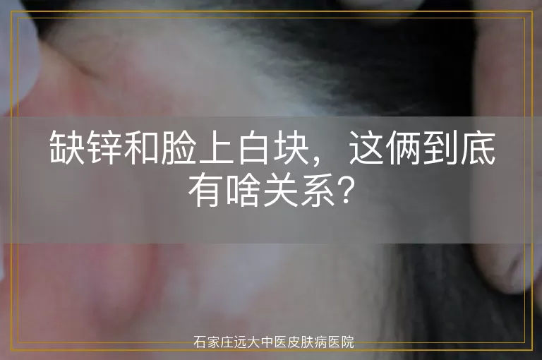 缺锌和脸上白块，这俩到底有啥关系？