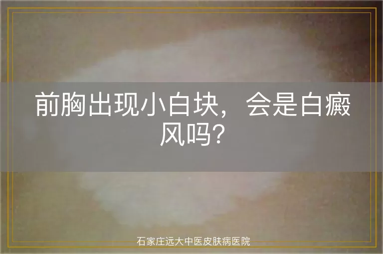 前胸出现小白块，会是白癜风吗？