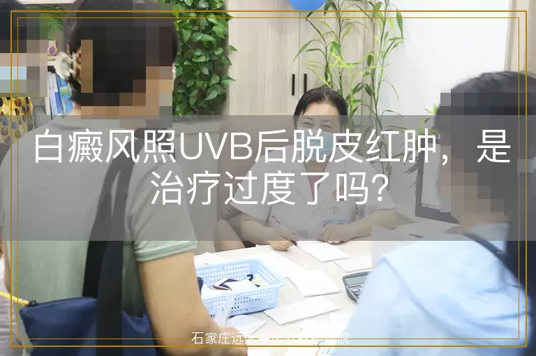 白癜风照UVB后脱皮红肿,是治疗过度了吗?