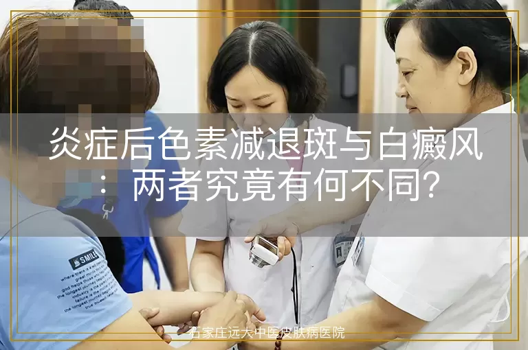 炎症后色素减退斑与白癜风：两者究竟有何不同？