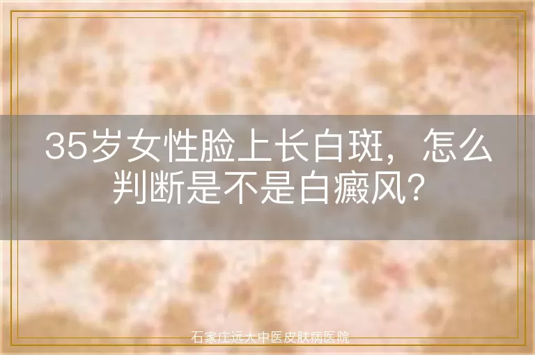 35岁女性脸上长白斑，怎么判断是不是白癜风？
