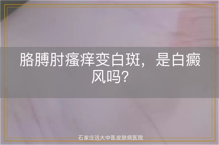 胳膊肘瘙痒变白斑，是白癜风吗？