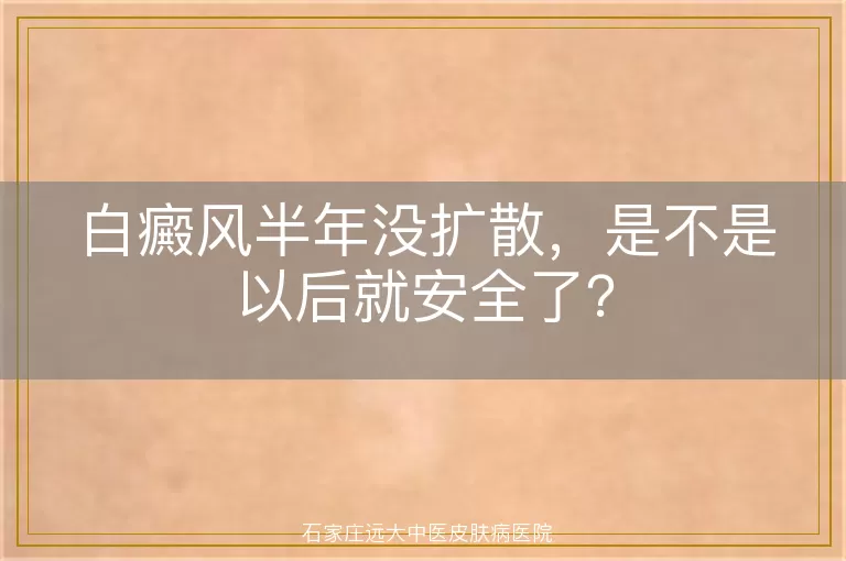白癜风半年没扩散，是不是以后就安全了？