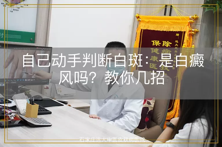 自己动手判断白斑：是白癜风吗？教你几招
