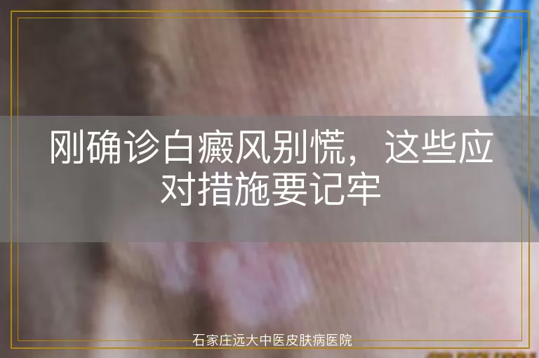 刚确诊白癜风别慌，这些应对措施要记牢
