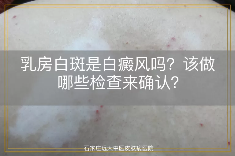 乳房白斑是白癜风吗？该做哪些检查来确认？