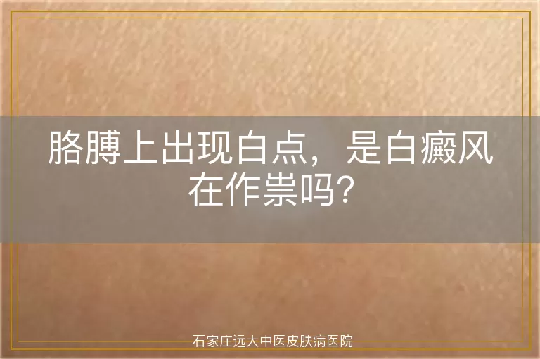 胳膊上出现白点，是白癜风在作祟吗？