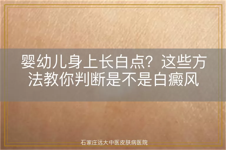 婴幼儿身上长白点？这些方法教你判断是不是白癜风